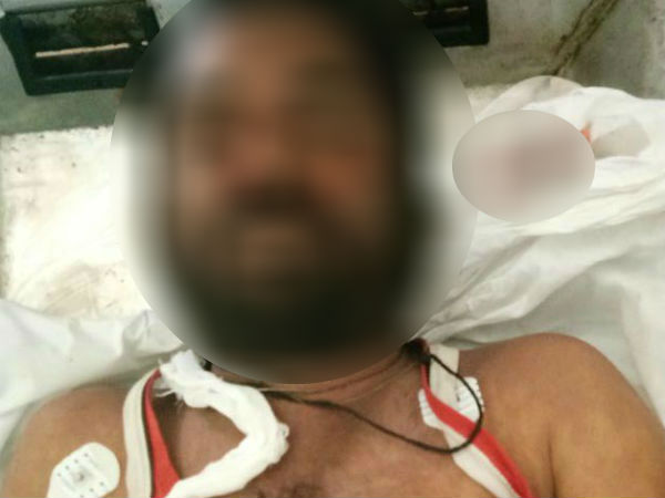 Honey bee attack in Muttatti, man dies Honey bee attack in Muttatti, man dies