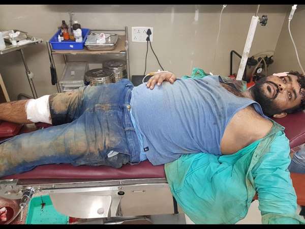 ಮತ್ತೆ ತಪ್ಪಿಸಿಕೊಂಡ ಸರಗಳ್ಳ