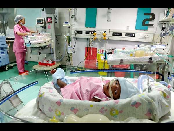 30 days girl child born prematurely and on ventilator