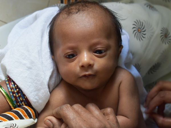 Please help this 8 month old Anirudh to get third stage of treatment