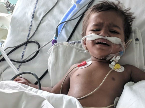 Little Bhima Bravely Fights Multiple Organ Failure