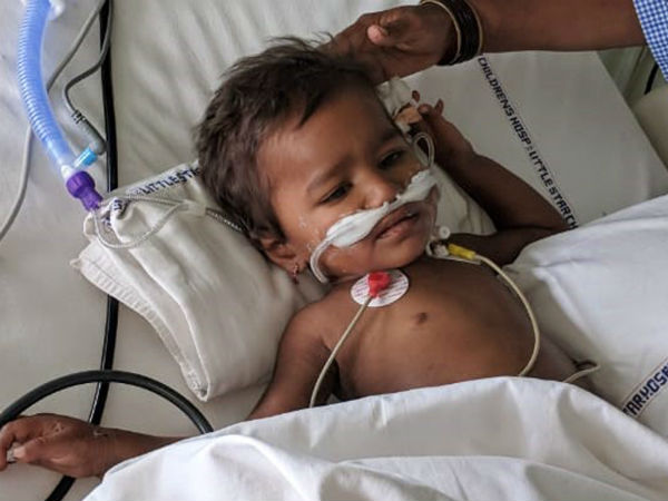 Little Bhima Bravely Fights Multiple Organ Failure