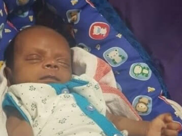 A Month Old Baby Struggles To Breathe Due To Heart Disease