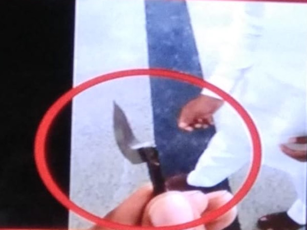 ಜಗನ್ ಮೇಲೆ ಕೊಲೆ ಯತ್ನ ಎಂದ ಪಕ್ಷ