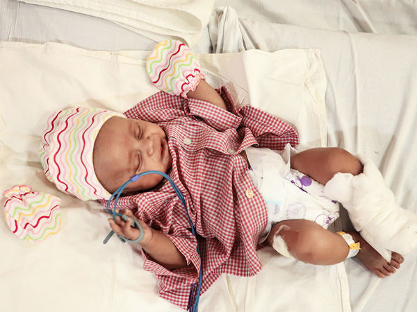 My 2 month old baby’s heart is not able to pump blood