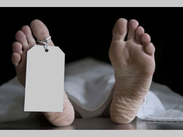 ಕಾಲ ಮೇಲೆ ಗಾಯದ ಗುರುತಿತ್ತು