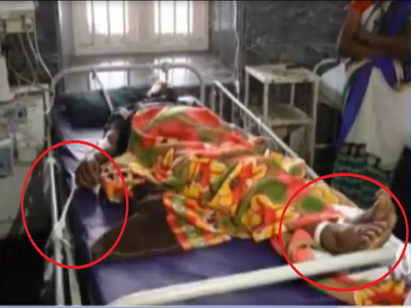 ಅಟ್ರೋಪಿನ್‌ ನಿಂದಾಗಿ ಹಿಂಸಾತ್ಮಕವಾಗಿ ವರ್ತಿಸುತ್ತಾರೆ ರೋಗಿಗಳು