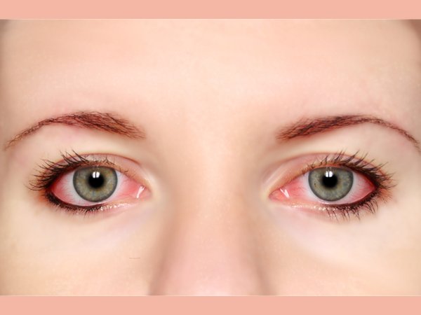 ದೃಷ್ಟಿಸಮಸ್ಯೆಯಿಂದ ಮಕ್ಕಳ ಬಳಲಿಕೆ 