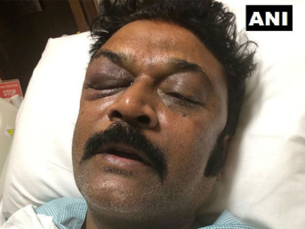 ಬಾಟಲಿಯಿಂದ ಹಲ್ಲೆ? ಹೂ ಕುಂಡದಿಂದ ಹಲ್ಲೆ?