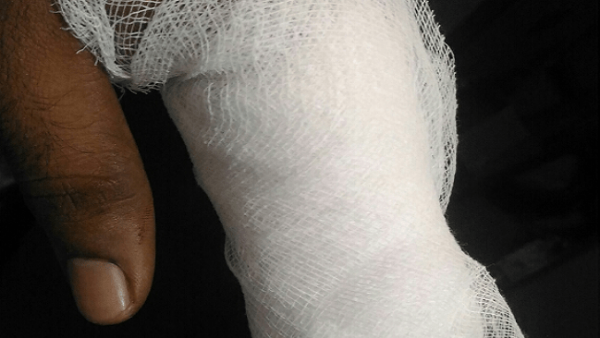 Nikhil Kumaraswamy follower choped his finger 