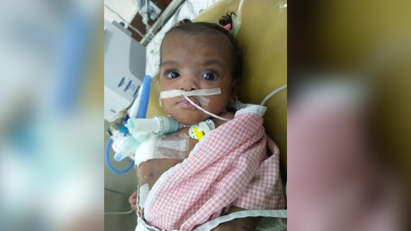 ಪಿಡಿಎ (ಪೇಟೆಂಟ್ ಡಕ್ಟಸ್ ಆರ್ಟಿರಿಯೋಸಸ್) ಸ್ಟೆಂಟಿಂಗ್