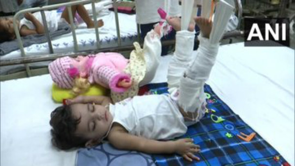 'ಸ್ಟಡಿ ಪುಲ್ಲಿಂಗ್' ಪದ್ಧತಿ