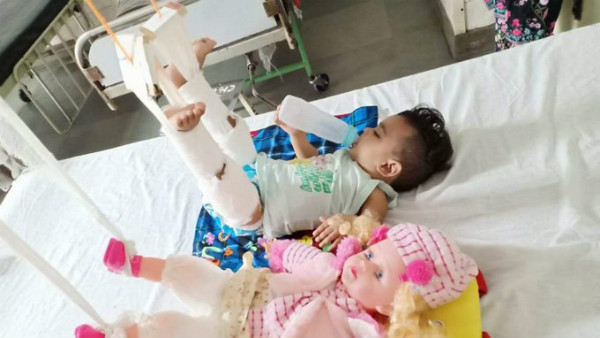 ವೈದ್ಯರಿಗೂ ಅಚ್ಚರಿ ಮೂಡಿಸಿದ ಮಗು