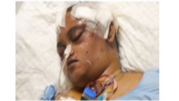 Unaware of his mother’s critical condition, 13-year-old is waiting for her back home 