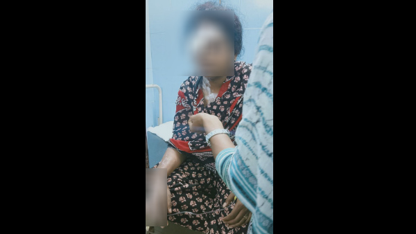 Acid Attack On Girl In Haveri Acid Attack On Girl In Haveri