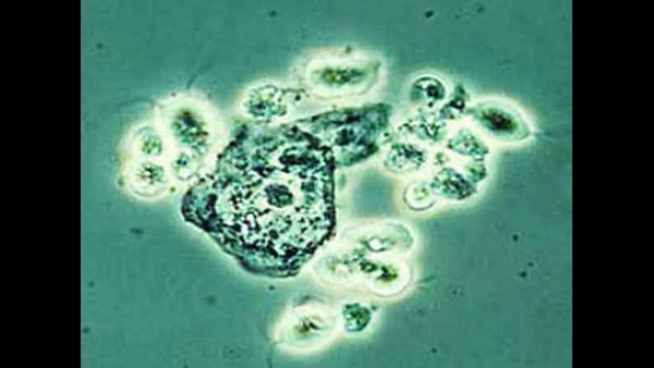  ಯಾರಾ ವೈರಸ್ ಹೆಸರು ಬಂದಿದ್ದೇಕೆ?