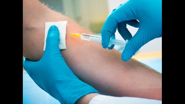 20 ರಿಂದ 40 ವರ್ಷದವರಗೆ ಹೆಚ್ಚಾಗಿ ಮೃತಪಟ್ಟಿದ್ದು 