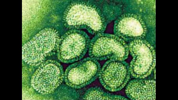 81 ಮಂದಿಗೆ ಹಂದಿ ಜ್ವರ