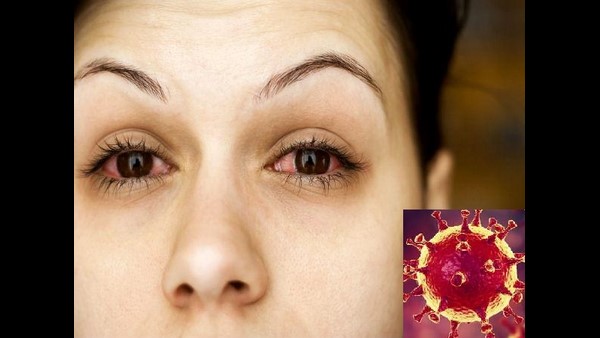 ಕೊರೊನಾ ಸೋಂಕು ಹರಡುವಿಕೆ ಕಡಿವಾಣ ಯಾವಾಗ? 