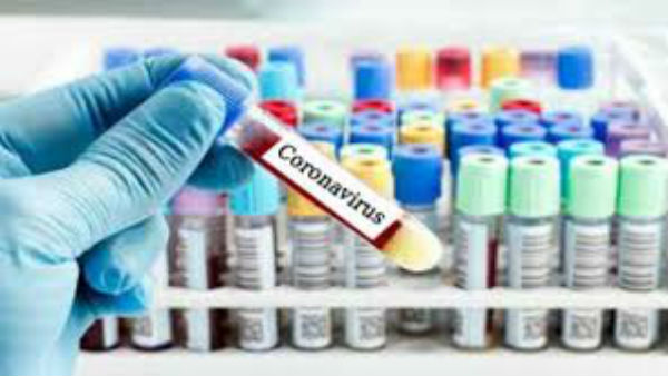  ಪರೀಕ್ಷೆಗೆ ಪುಣೆಗೆ ಹೋಗಿರುವ ಮಾದರಿ