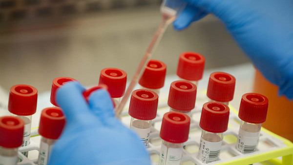 ಐದು ನಿಮಿಷಗಳಲ್ಲಿ ಕೋವಿಡ್ ಫಲಿತಾಂಶ 