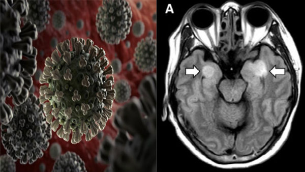 ಬಿಸಿಲಿನಲ್ಲಿ ತಗ್ಲಾಗೊಂಡರೆ ಅನಾರೋಗ್ಯಕ್ಕೆ ತುತ್ತಾಗುವ ಭೀತಿ 