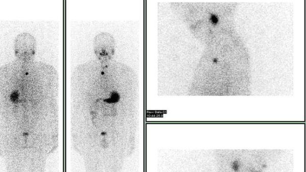 ಐಸೋಪೊಪ್(ಸಮಸ್ಥಾನಿ) ಎಂಬುದರ ಅರ್ಥವೇನು? 