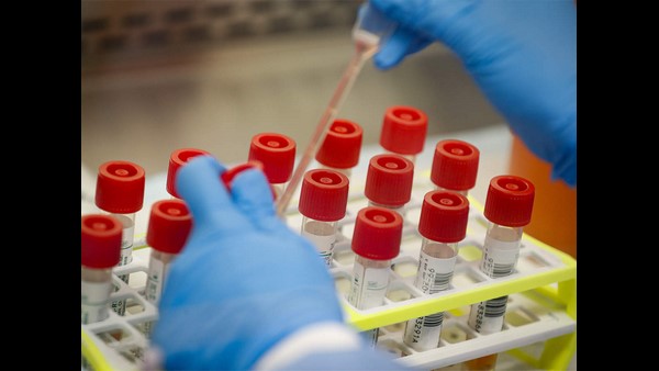 ದಿನಕ್ಕೆ ಸರಾಸರಿ 20 ರಿಂದ 40 ಕ್ಕೆ ಏರಿಕೆ