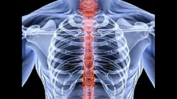 ಆಸ್ಟಿಯೋಪೊರೊಸಿಸ್ ಗೆ ಒಂದು ಉದಾಹರಣೆ 