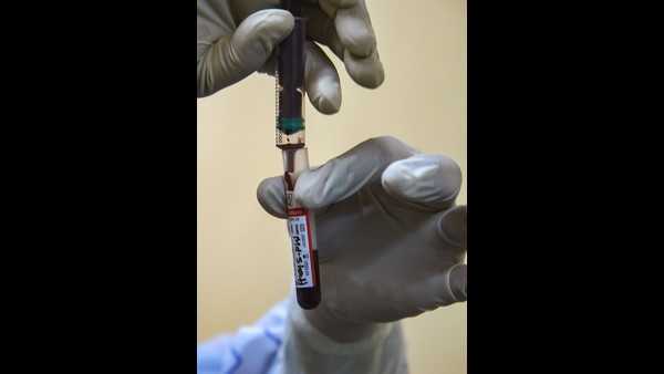 ಶೂನ್ಯ ಆಂಟಿಬಾಡಿ ಉತ್ಪಾದನೆ ಬಗ್ಗೆ ಉಲ್ಲೇಖ 