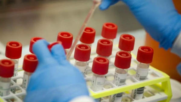 ಲಸಿಕೆ ಸಂಶೋಧನಾ ಕಾರ್ಯದಲ್ಲಿ ಭಾರತದ ಆರು ಕಂಪನಿ 