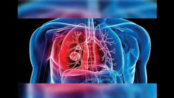 ಕ್ಷಯದ ಲಕ್ಷಣವಿದ್ದರೆ... ಕ್ಷಯದ ಲಕ್ಷಣವಿದ್ದರೆ...