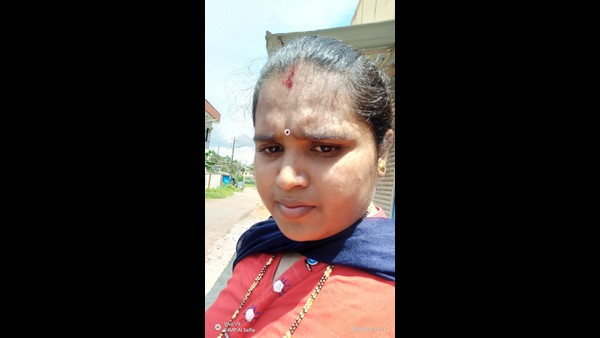 Udupi: Woman Dies After Taking Treatment For Headache In Private Hospital
