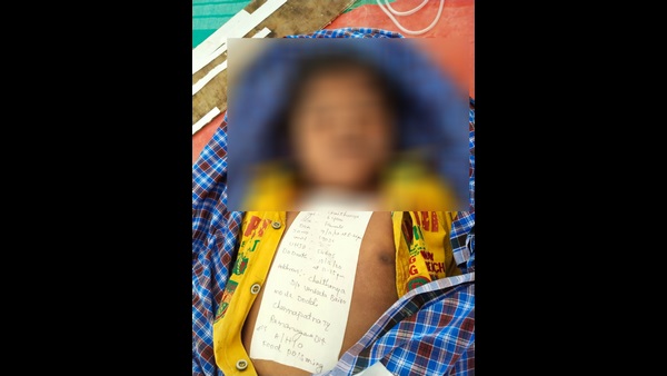 Ramanagara: 6-Year-Old Girl Dies After Eating Meat 