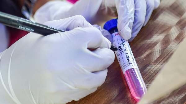 ಸಾವಿನ ಸಂಖ್ಯೆಯೂ ಇಳಿಕೆ