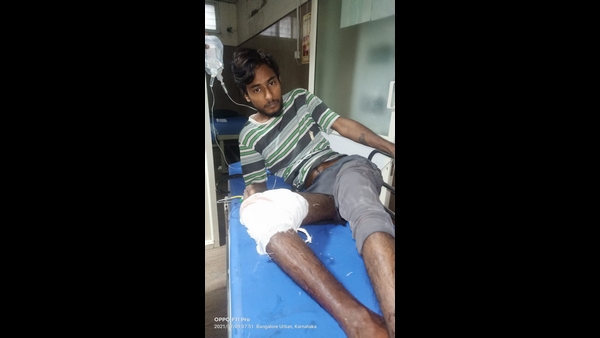 Bengaluru : Rajagopala Nagara Police Open Fire at Rowdy-Sheeter Santhosh, Arrested