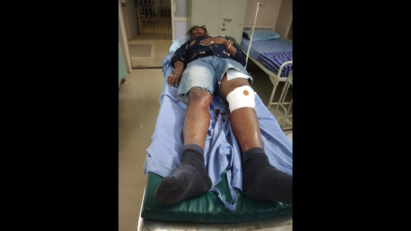 Bengaluru ; Yelahanka police opened fire on rowdy sheeter