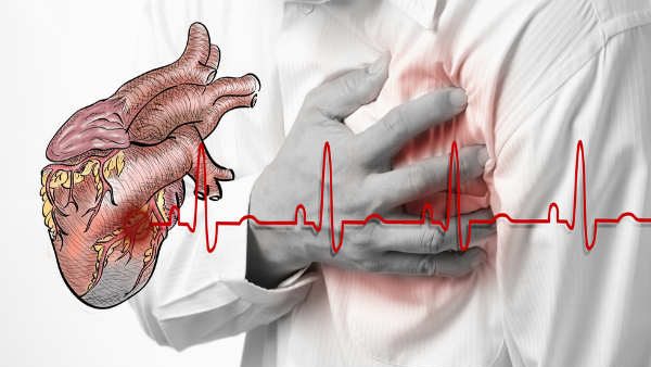 ಎದೆನೋವು ನಿರ್ಲಕ್ಷ್ಯ ಮಾಡಬೇಡಿ 