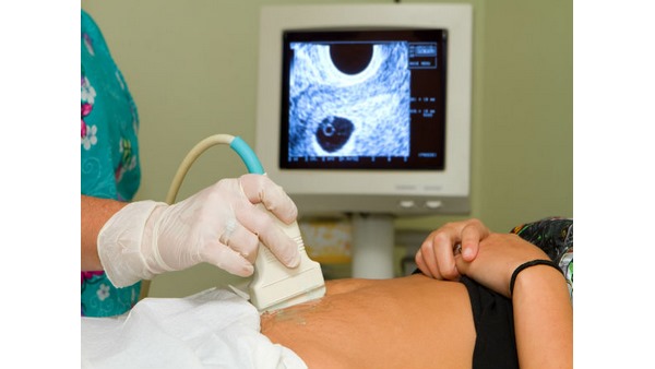  ಪಿಸಿಒಎಸ್ ರೋಗನಿರ್ಧಾರ ಹೇಗೆ ?