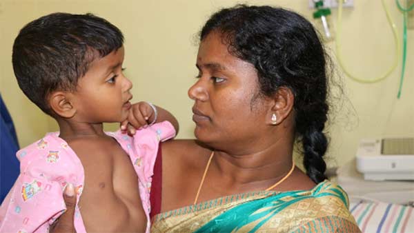 Help 2 Year Brindha Recover From Heart Problem 