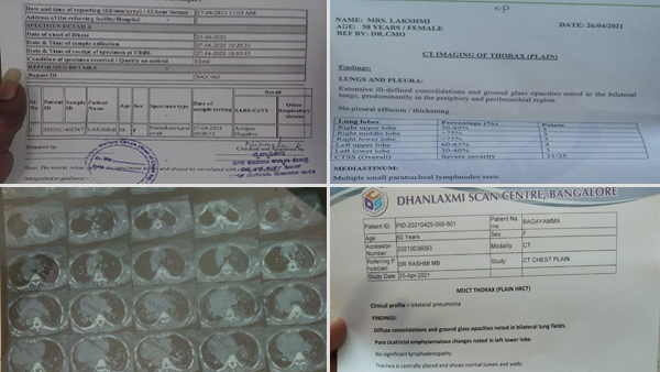 Covid 19: Negative in RT-PCR Test: Positive in CT Scan