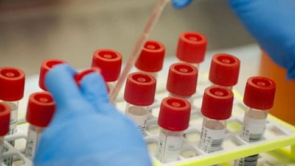 ಬಿಯು ನಂಬರ್ ಇಲ್ಲ ಅಂದ್ರೆ ಬೆಡ್ ಸಿಗಲ್ಲ: 