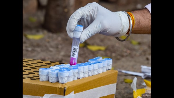 ಸ್ವಯಂ ಪರೀಕ್ಷಾ ಕಿಟ್‌ನ ಬೆಲೆ ಎಷ್ಟು?