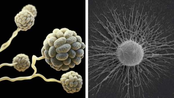  ವೈಟ್ ಫಂಗಸ್ ಲಕ್ಷಣಗಳೇನು?