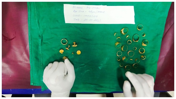  Mangaluru: Thief Who Swallowed A Gold Ring To Escape From The Police