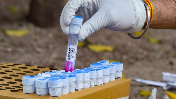 ಕಡಿಮೆಯಾದ ಟೆಸ್ಟುಗಳು