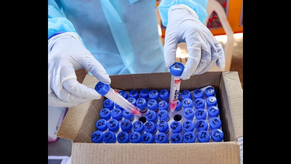 ಕರ್ನಾಟಕದ ಯಾವ ಜಿಲ್ಲೆಯಲ್ಲಿ ಎಷ್ಟು ಕೊವಿಡ್-19 