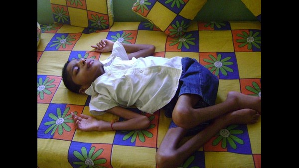 ಖಿನ್ನತೆ ಹಾಗೂ ಹಾರ್ಮೋನ್ ಸಂಬಂಧಿತ ರೋಗ