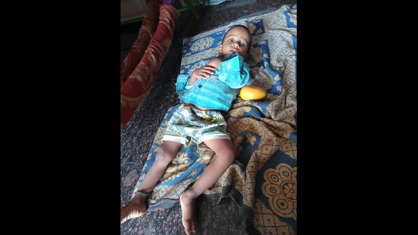  ಚಿಕಿತ್ಸೆಗೆ 3,00,000 ರೂ ಅಗತ್ಯವಿದೆ