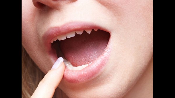  ಬಾಯಿ ದುರ್ವಾಸನೆ ಬರುತ್ತದೆ